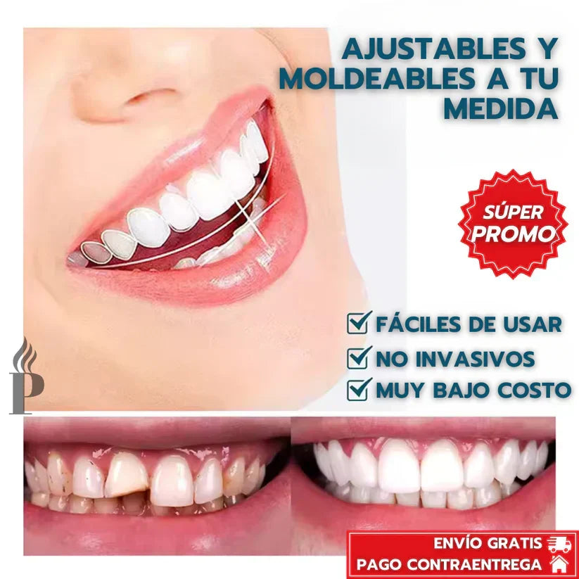 Snap-On Smile™: Carillas Dentales Ajustables - Dientes de Cerámica